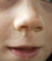 Thumbnail for version as of 18:38, 10 August 2025
