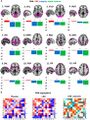 Thumbnail for version as of 18:43, 10 August 2025